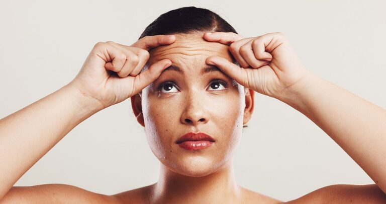 how to treat forehead lines