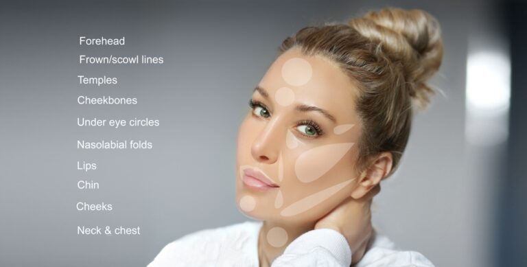 wrinkle treatment areas