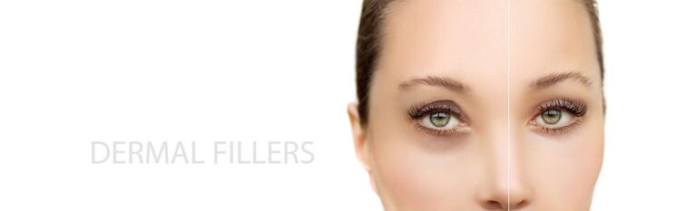 tear trough dermal fillers