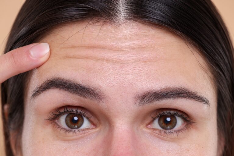 how to get rid of wrinkles on forehead