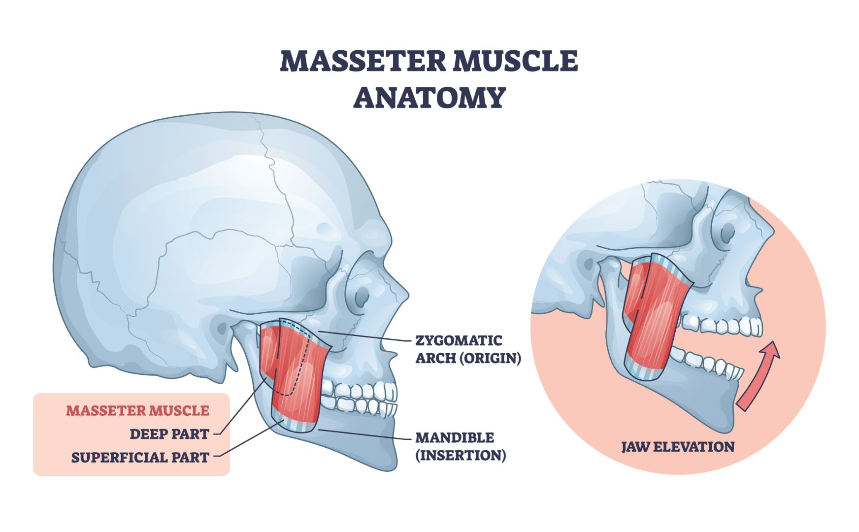 Medical illustration of masseter muscle anatomy showing the skull, mandible insertion, zygomatic arch origin, and jaw elevation movement